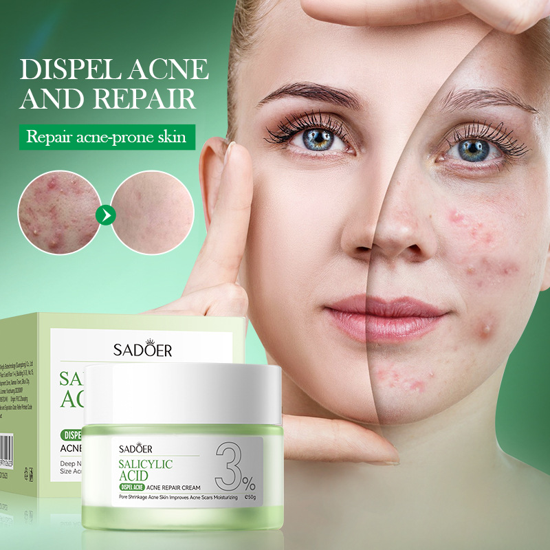 Salicylic Acid Blackhead Remover - Crema de Tratamiento para el Acné