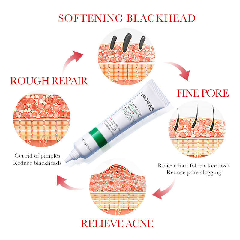 1/2/3 Uds BIOAQUA crema Facial - Salicylic Acid Blackhead Remover reseña y precio