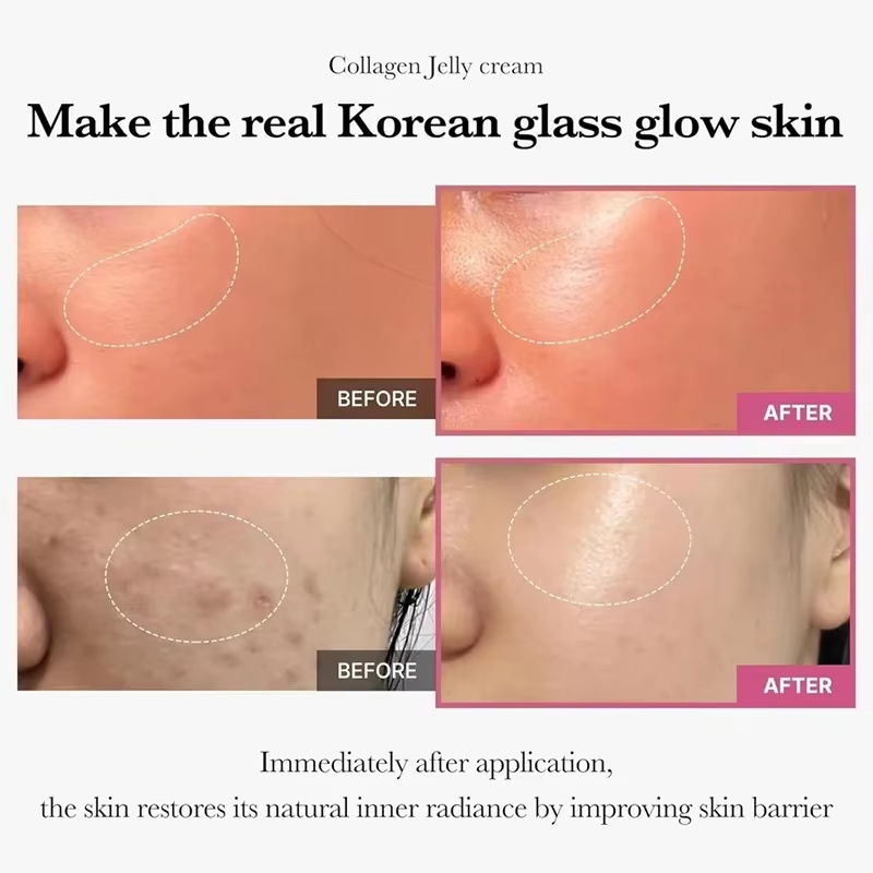 Crema Facial en Gel de Colágen - Niacinamide Pore Shrinking Essence reseña y precio