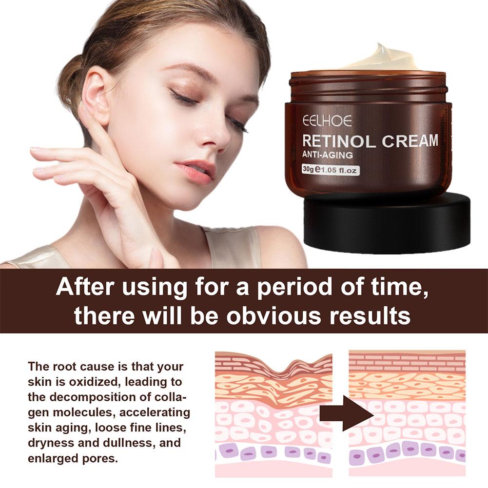 EELHOE 1/2/3/5PCS (Compre 3 y  - Retinol Anti Wrinkle Cream reseña y precio