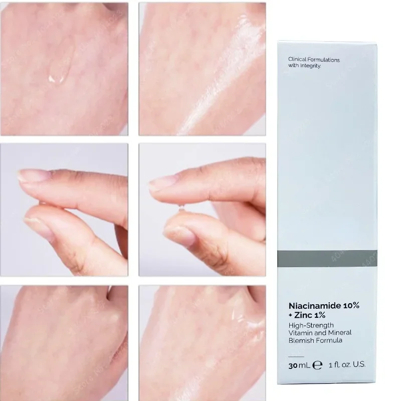 Esencia blanqueadora de magnes - Niacinamide Pore Shrinking Essence reseña y precio