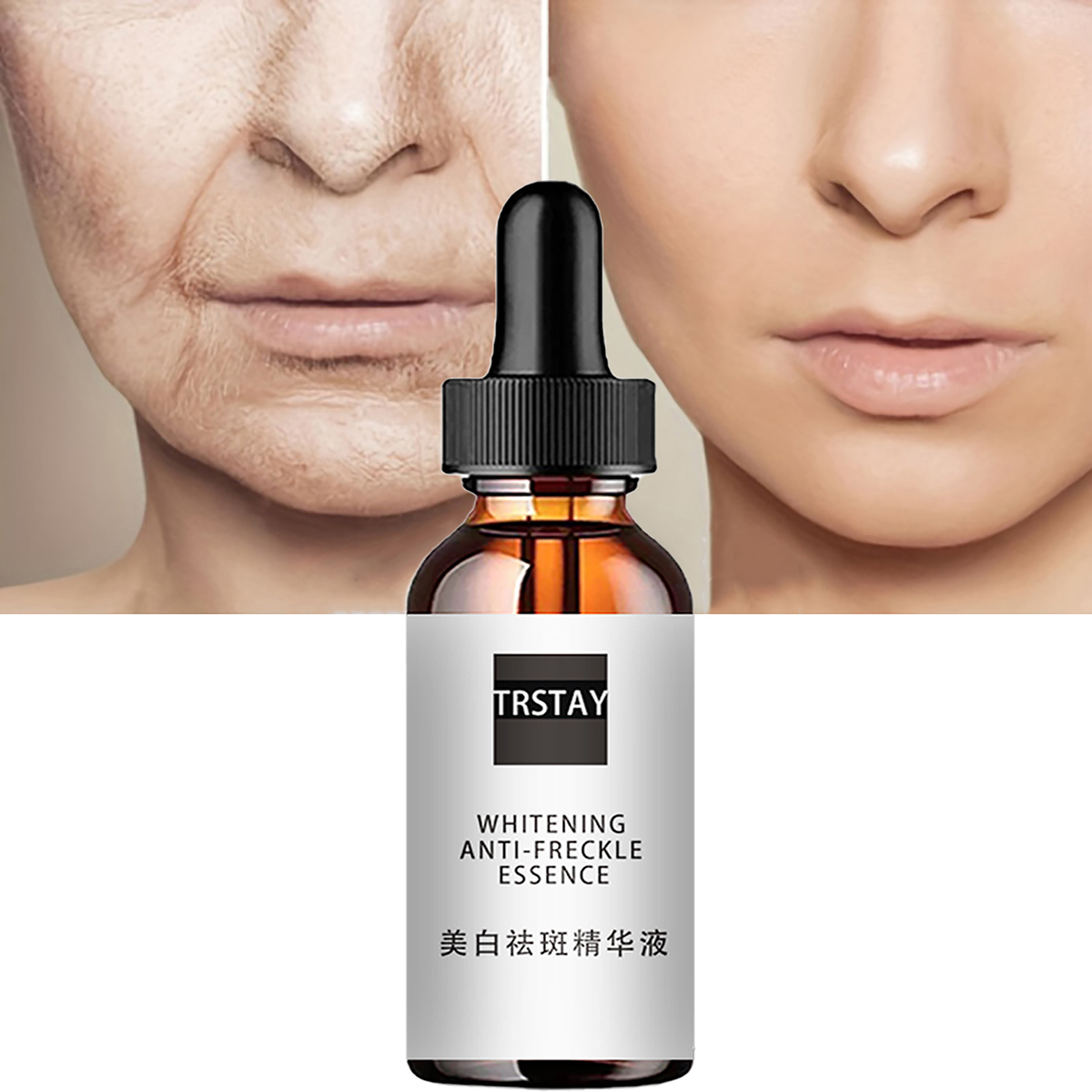 Esencias faciales con ácido de - Niacinamide Pore Shrinking Essence reseña y precio