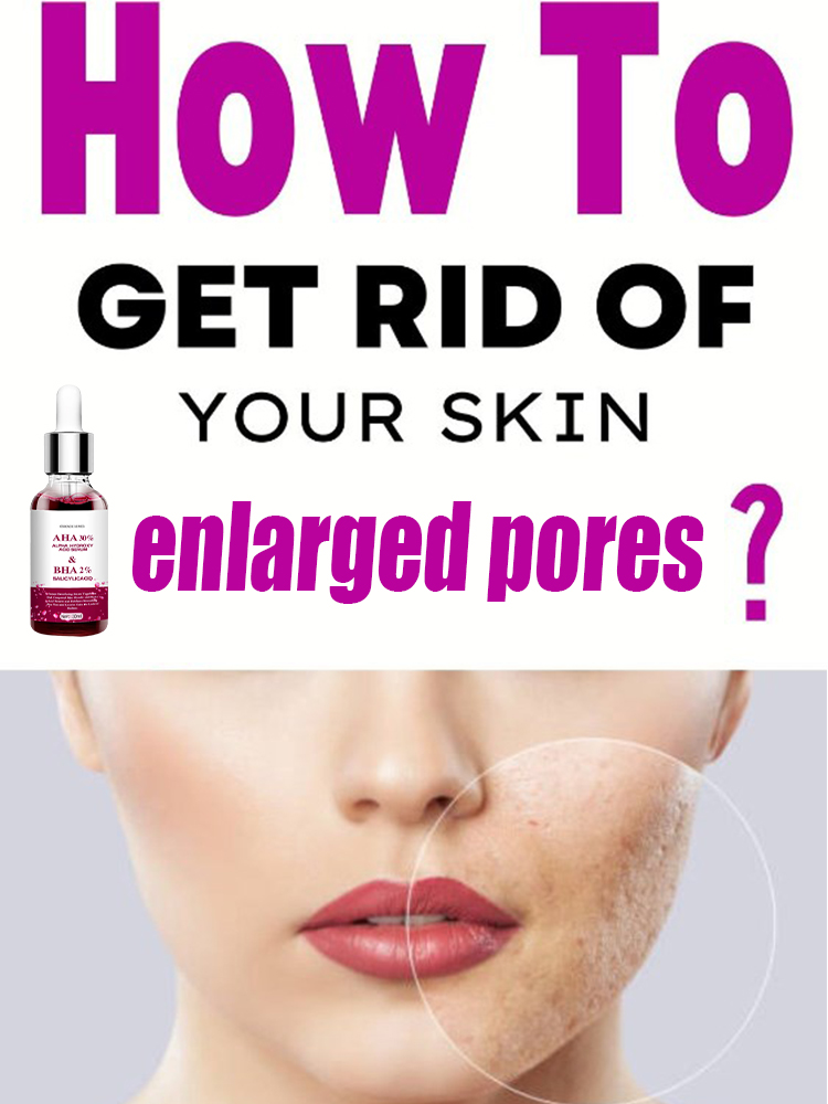 Suero para reducir los poros,  - Salicylic Acid Blackhead Remover reseña y precio