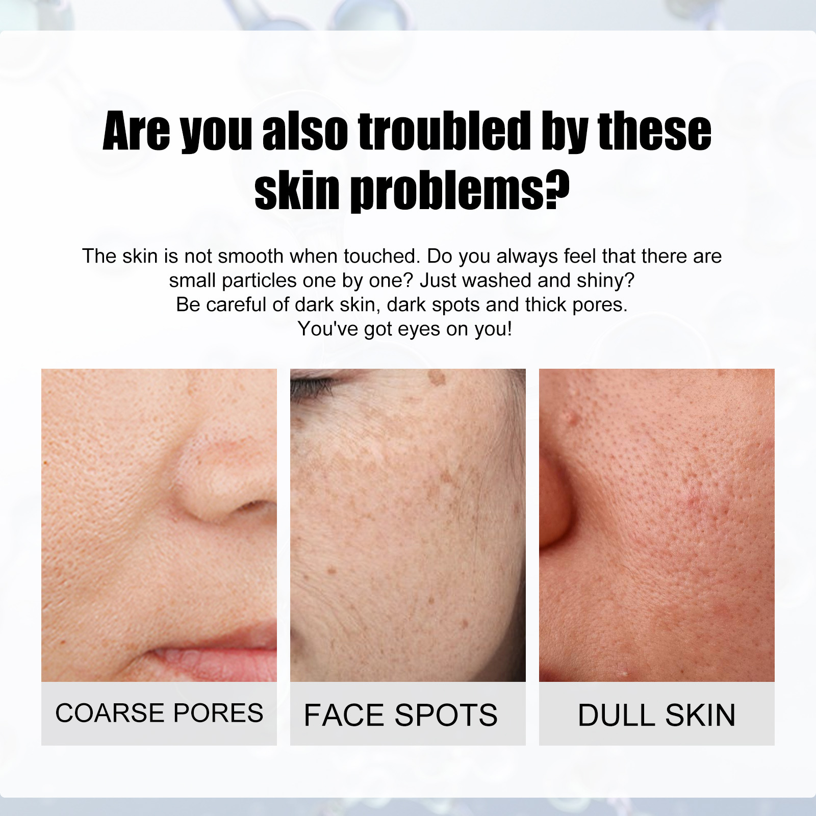 Suero Facial blanqueador, redu - Niacinamide Pore Shrinking Essence reseña y precio